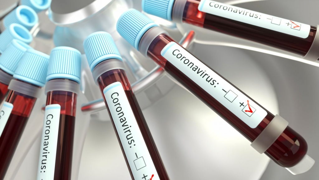 Тесты на коронавирус 